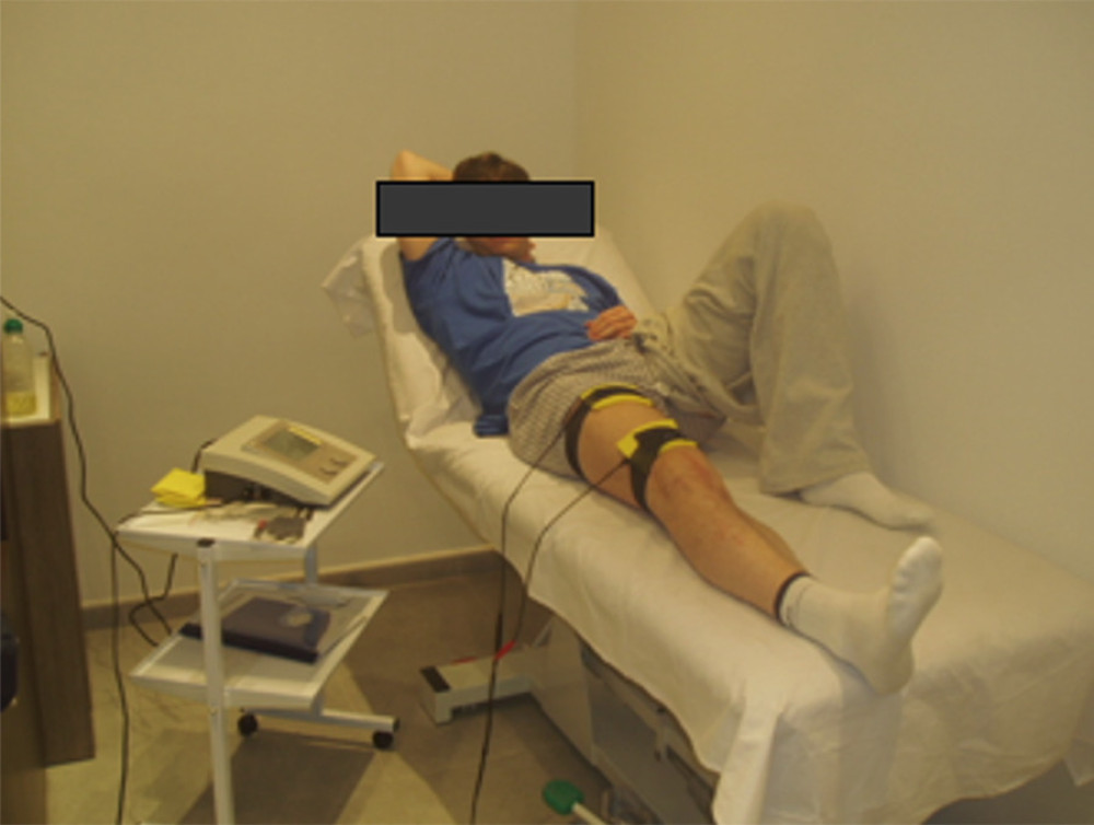 After the first week of reconstruction, the application of electroanalgesia was started.