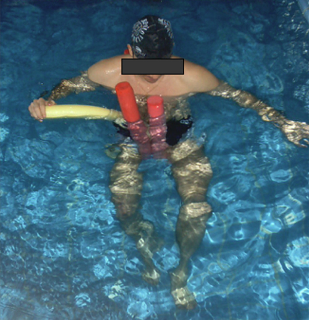 Non-weight-bearing proprioception exercises in a pool to improve joint mobility without overloading the repaired structures.