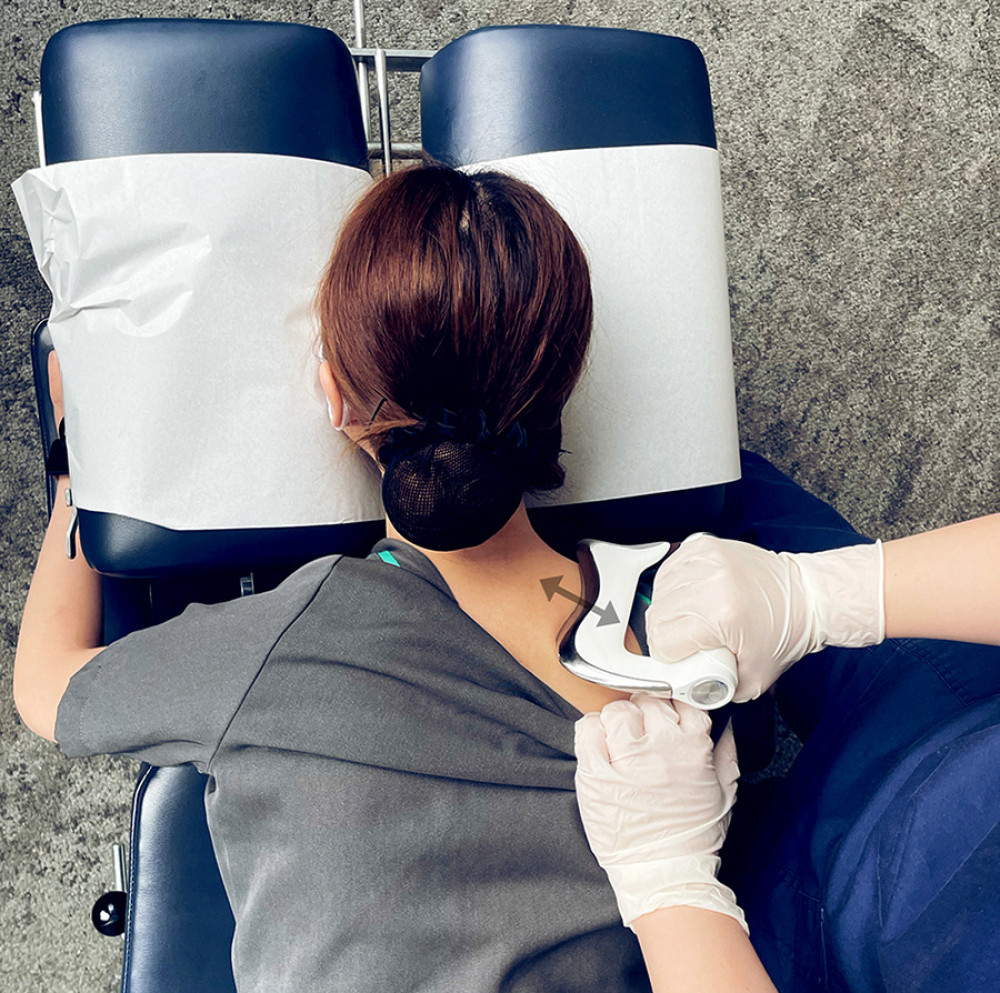 Instrument-assisted soft tissue manipulation. The provider applies emollient to the skin surface then gently strokes a massage tool (Strig, Korea) across the skin surface (arrows). This treatment was applied in the region of the upper trapezius (shown), as well as the rhomboids and levator scapulae muscles bilaterally.