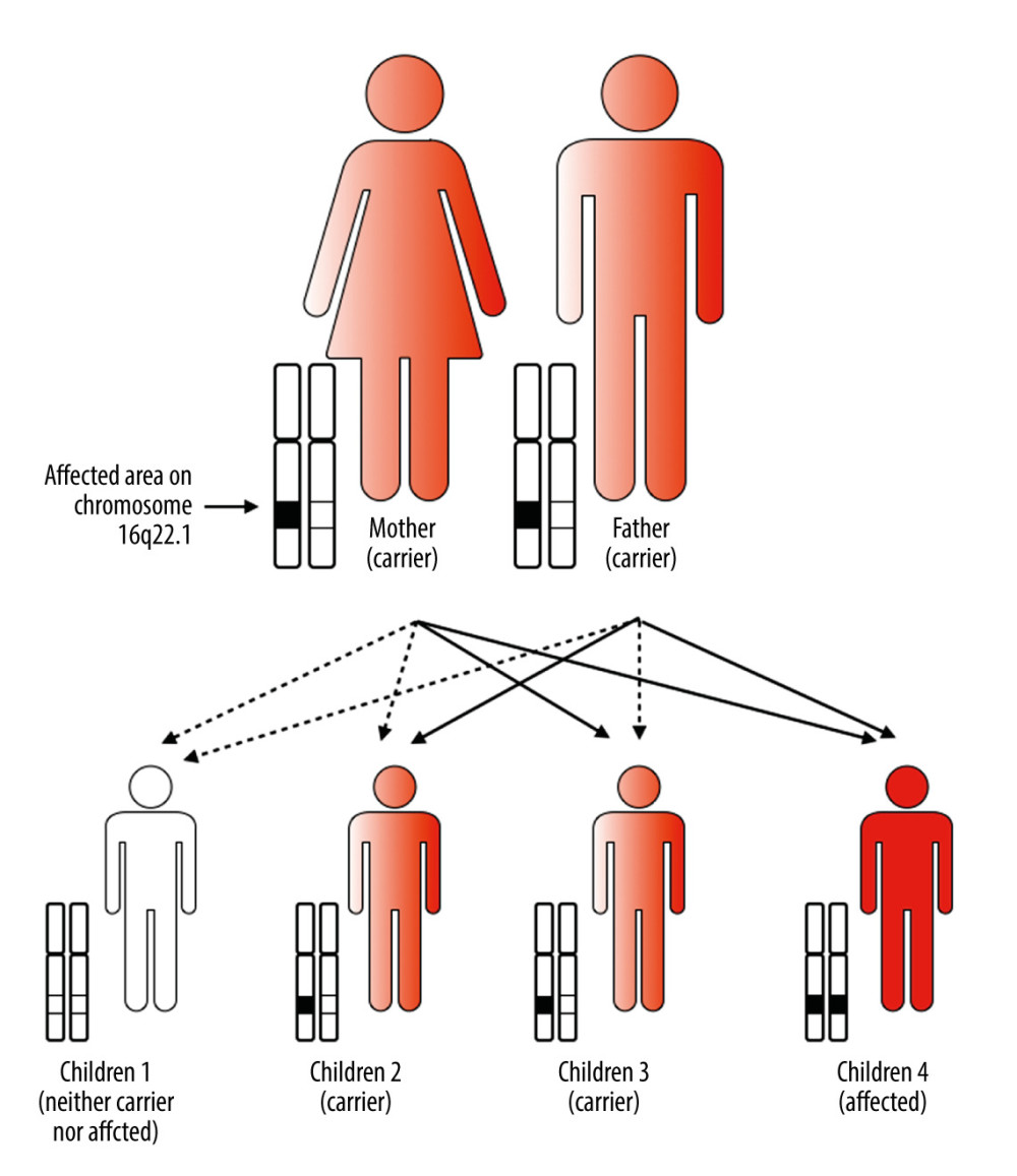 Illustration of the inheritance pattern in TYRII (ie, autosomal recessive).