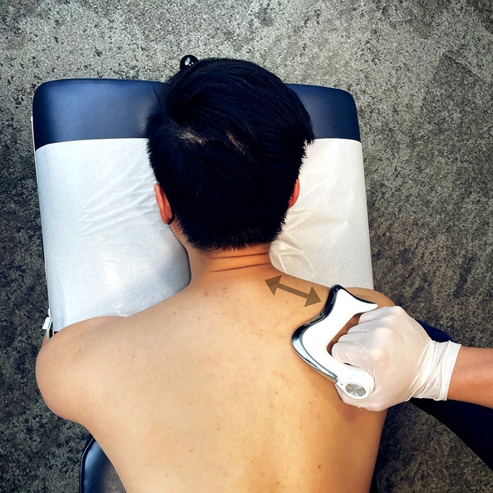 Instrument-assisted soft tissue manipulation. The clinician applies a thin layer of emollient to the skin surface, and utilizes a massage tool (Strig, Korea) to gently stroke along the targeted muscles. In the image shown, strokes are applied to the right levator scapula (arrows).