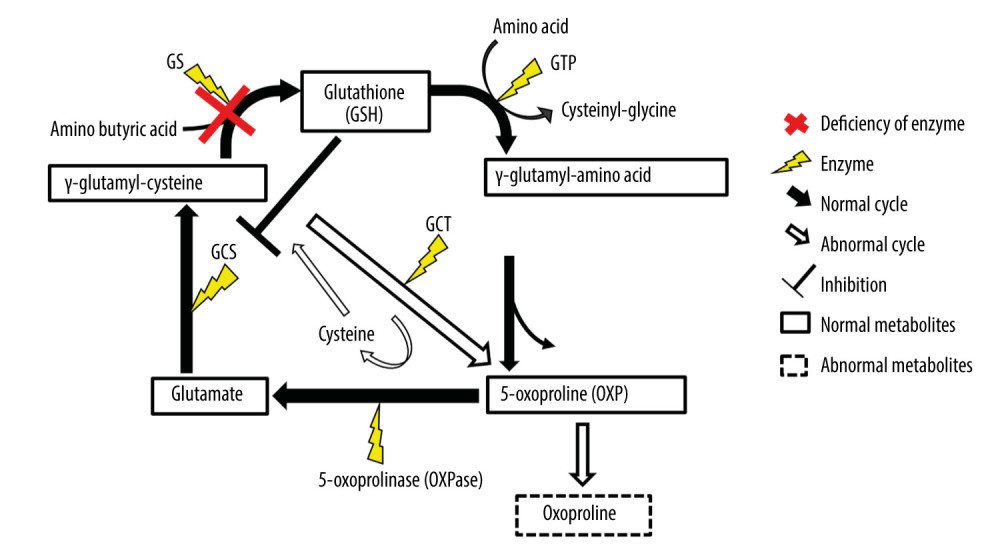 γ-Glutamyl cycle. Glutathione (GSH) is synthesized from glutamine and cysteine by γ-glutamylcysteine synthetase (GS) and glutathione synthetase (GSS) during the γ-glutamyl cycle. In patients with glutathione synthetase deficiency (GSD), the reduction in GS activity leads to the intracellular accumulation of γ-glutamylcysteine, which is converted to 5-oxoproline (OXP) and cysteine, with the resultant increase in 5-OXP concentration in blood and urine. This figure was created by Satoshi Ekuni, based on data from Ristoff E, Larsson A. Inborn errors in the metabolism of glutathione. Orphanet J Rare Dis 2007; 2: 16.