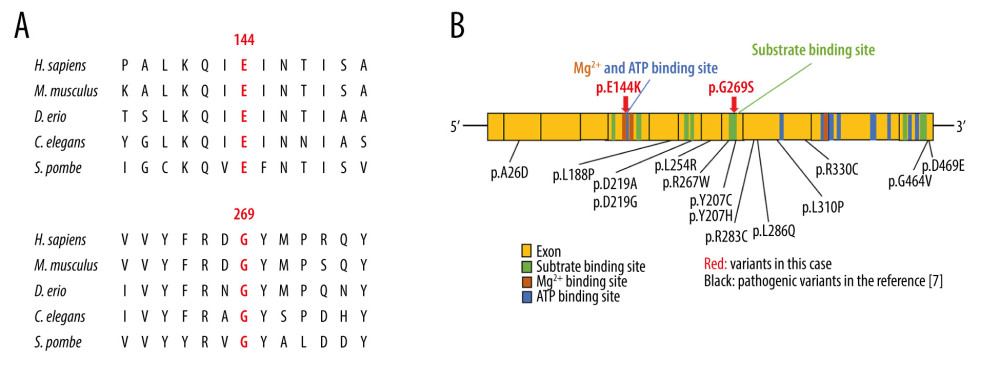 (A) Amino acid conservation among species in the GSS. The Glu144 and Gly269 residues was highly conservation of among species in GSS. (B) A scheme of the predicted binding sites in the human glutathione synthetase cDNA and missense variants. GSS is composed of 13 exons. The variants in this case are shown in red arrow. Fourteen pathogenic missense variants in GSS [7] are indicated in black. The Glu144 residue is in a magnesium binding site and ATP binding site. The p.G269S in this case is in the vicinity of the pathogenic variants. This figure was created from data provided in previous studies [7,18,19].