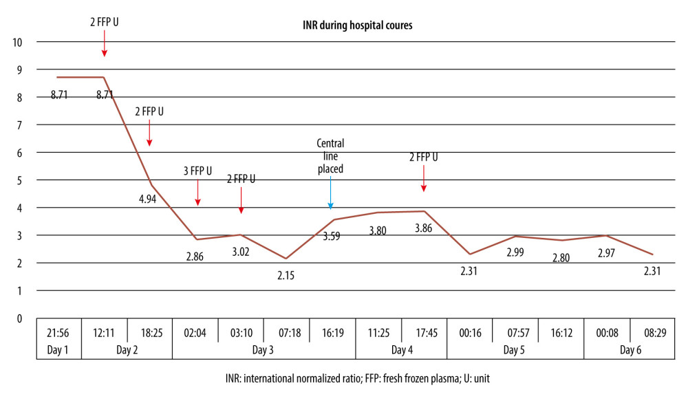 INR trend and blood product transfusion over hospital course.