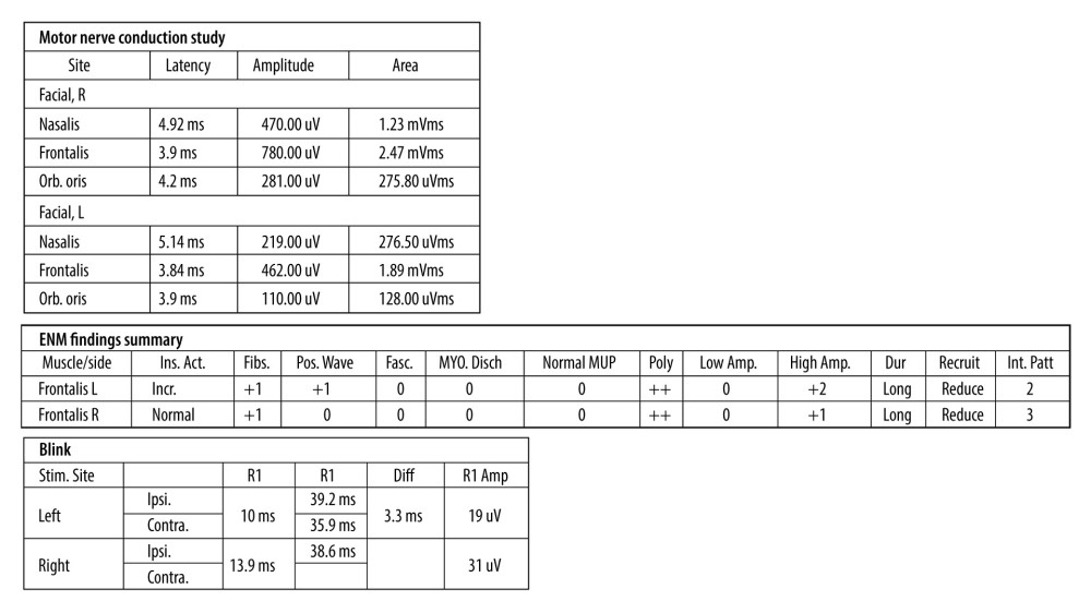 Facial nerve electrophysiological study.