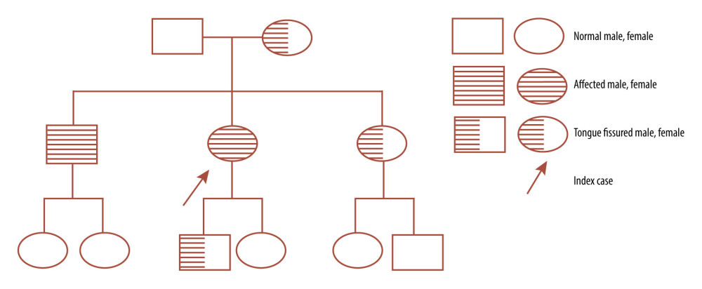 Pedigree chart.