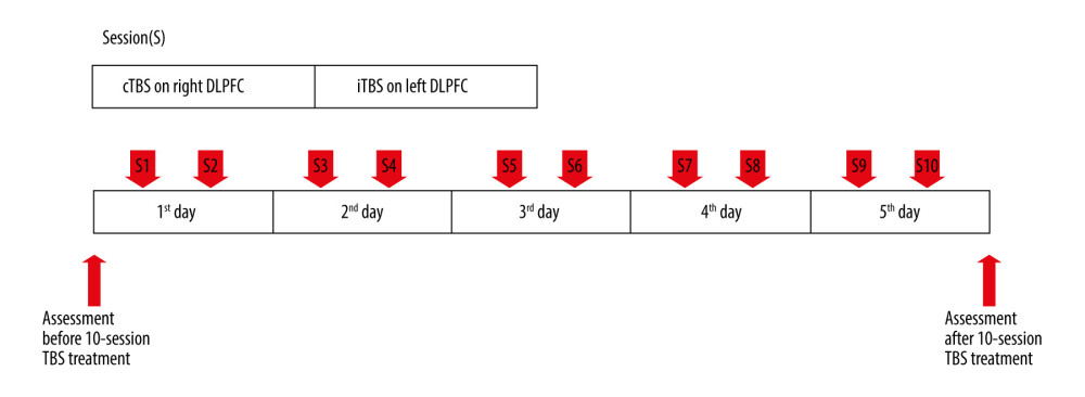 Accelerated TBS procedure timeline (cTBS over right DLPFC followed by iTBS over left DLPFC; 1200 pulses per session; twice daily over 5 consecutive days). cTBS – continuous TBS; DLPFC – dorsolateral prefrontal cortex; iTBS – intermittent TBS; TBS – theta-burst stimulation.