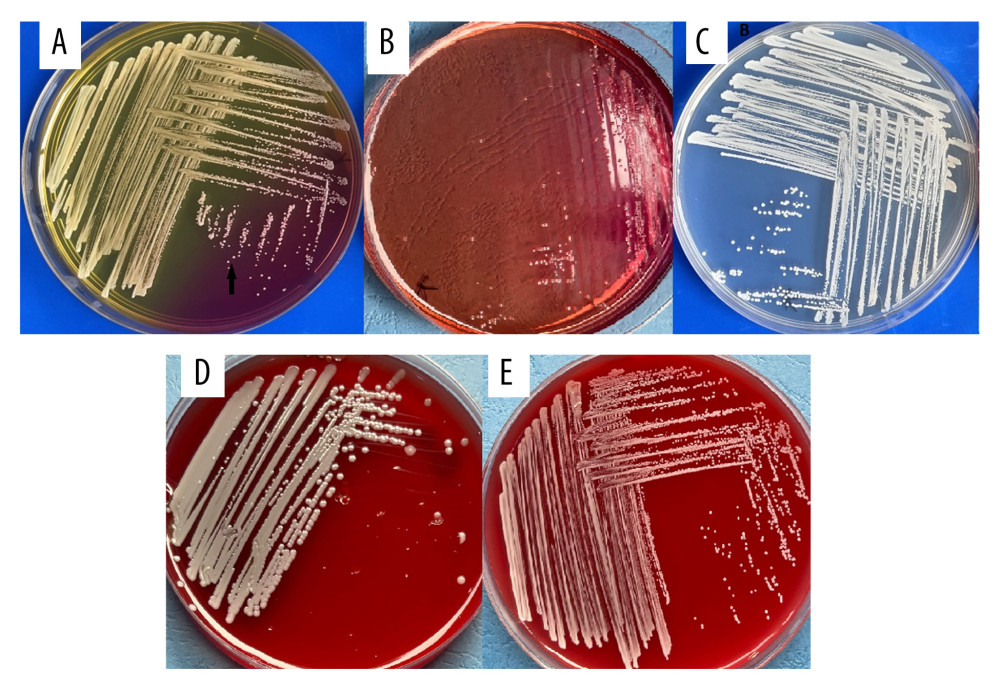 This shows the morphological characteristics of the mixed culture of the methicillin-resistant Staphylococcus aureus and the Kocuria rosea. The figure shows how Kocuria rosea can be missed if using only nutrient agar for presumptive identification. (A) Mixed culture of mannitol fermenting Staphylococcus aureus (yellow coloration) and non-mannitol fermenting Kocuria rosea (pink coloration) on mannitol salt agar. (B) A pure Kocuria rosea on mannitol salt agar. (C) The mixed culture on nutrient agar showing small, pale-cream colonies with the MRSA indistinguishable from the Kocuria rosea (D) Staphylococcus aureus on blood agar showing hemolysis. (E) Kocuria rosea on blood agar showing no hemolysis.