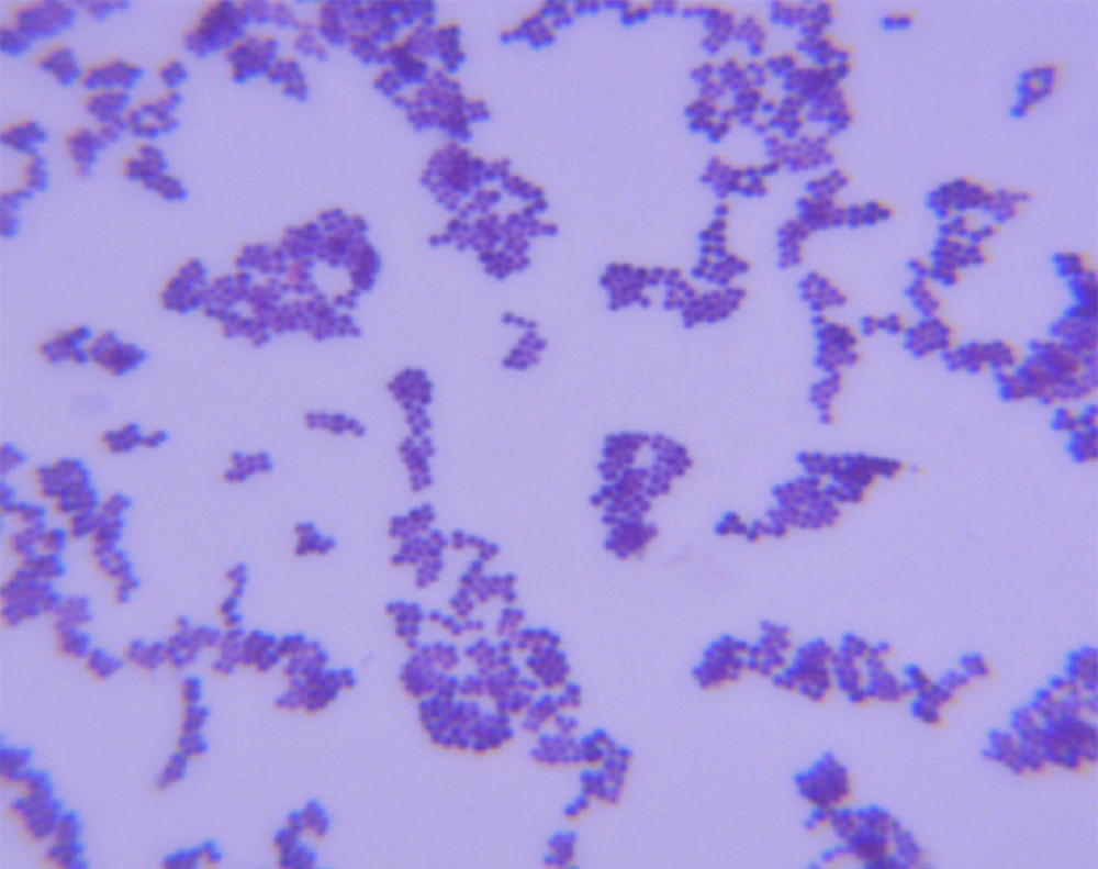 Gram-stain micrograph of the isolated Kocuria rosea showing gram-positive cocci in pairs, tetrads, or clusters, observed under oil immersion (×100).