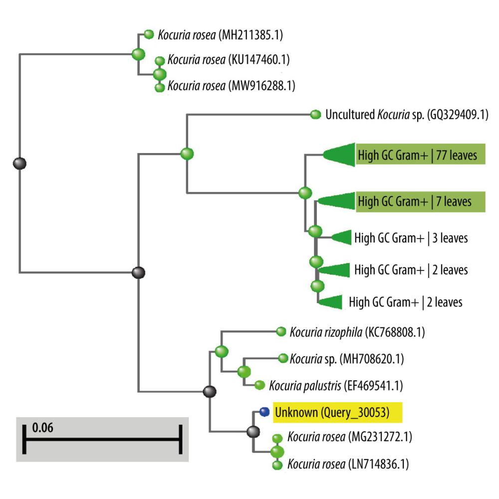 Phylogenetic analysis on the 16S rRNA gene sequences of isolated Kocuria species. This shows the clonal relatedness of this Kocuria rosea strain (depicted as unknown [Query_30053]) with other Kocuria rosea strain deposited in the NCBI database.