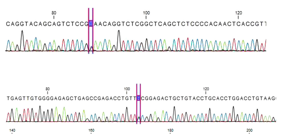 Sanger sequencing of NM_017730.3(QRICH1): c.337C>T; p.(Gln113*).