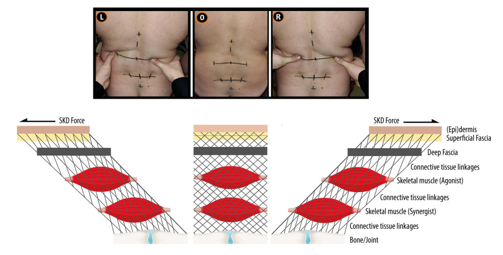 American Journal of Case Reports  Unlocking Pain Relief for Chronic Low  Back Pain: The Potential of the 4xT Method® – A Dual Case Study Analysis -  Article abstract #939284