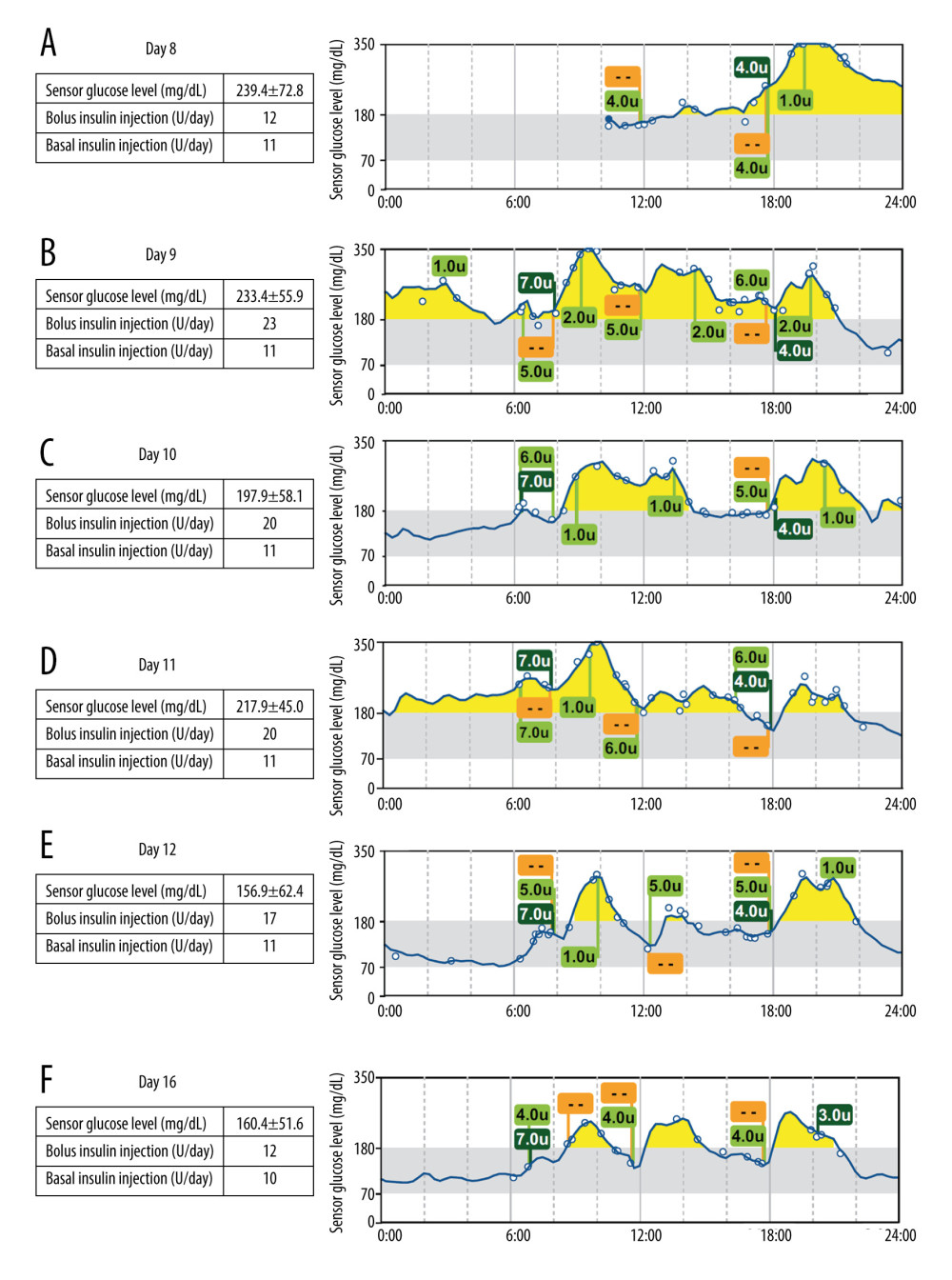 (A–F) Intermittently scanned continuous glucose monitoring data of interest. Orange squares indicate the meals taken, yellow green squares indicate the units of bolus insulin injected, and dark green squares indicate the units of basal insulin injected. Sensor Glucose level are mean±SD. The data for day 2 were partially missing due to the need to replace the isCGM; the data from day 7 (only available until 9: 00) to day 8 are missing because the CGM had to be removed during surgery (A) day 8, postoperative day 1; (B) day 9, postoperative day 2; (C) day 10, postoperative day 3; (D) day11, re-initiation of SGLT2 inhibitor therapy 1 day after discontinuation of SGLT2 inhibitor therapy; (E) day 12, 1 day after re-initiation of SGLT2 inhibitor therapy; and (F) day 16, 1 day before discharge.