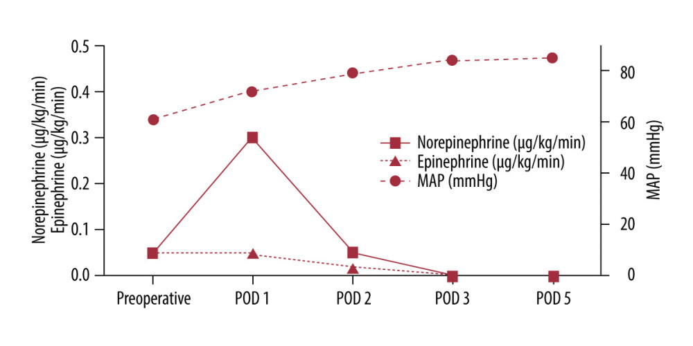 Perioperative course of hemodynamic parameters: mean arterial pressure, norepinephrine requirements, and epinephrine requirements.