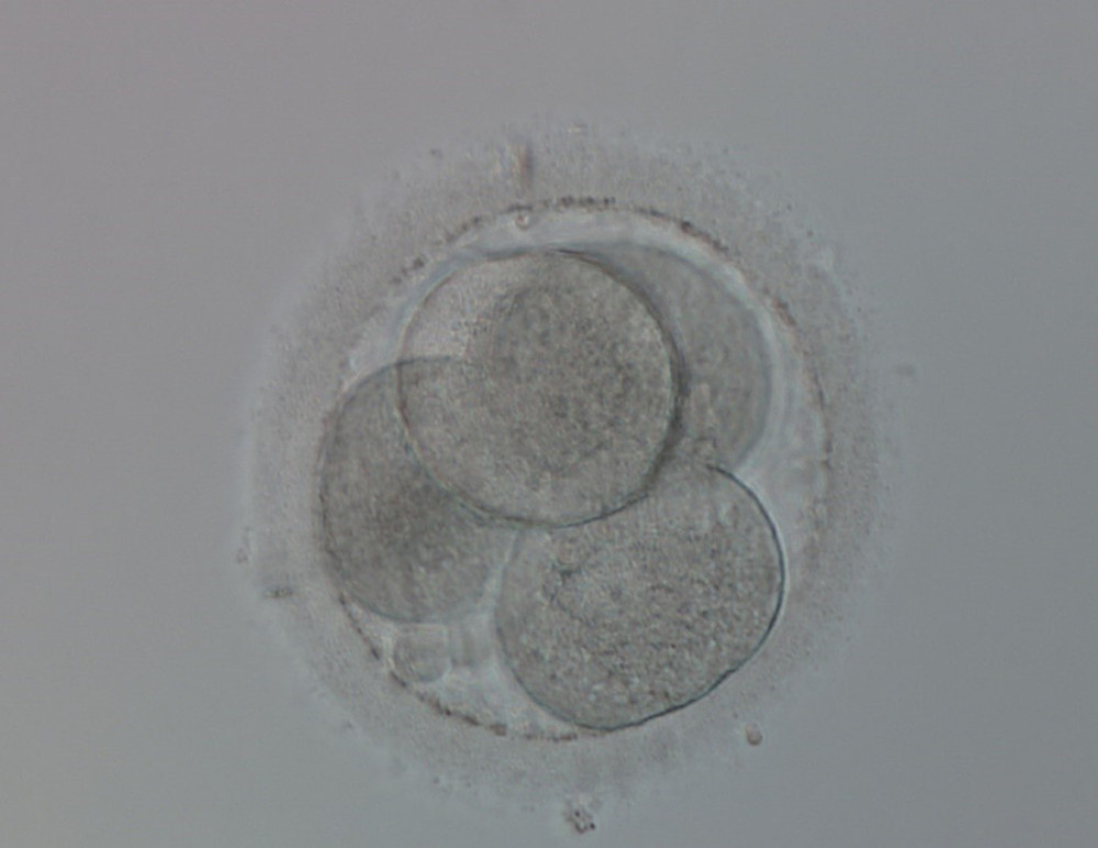 Cleaving embryo on day 2 after intracytoplasmic sperm injection: 4-cell embryo with four evenly sized blastomeres each one containing one nucleus (400× magnification).