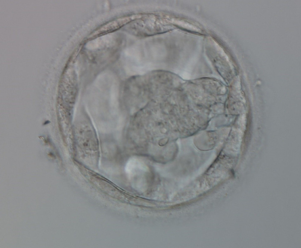 Blastocysts: Expanded blastocyst showing a large inner cell mass, which is made up of many cells that are tightly compacted (400× magnification).
