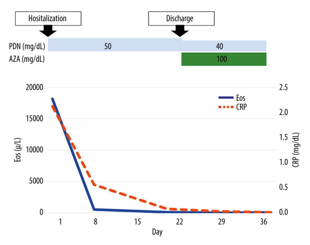 Clinical course during hospitalization. AZA – azathioprine; CRP – C-reactive protein; Eos – Eosinophils; PDN – prednisolone.