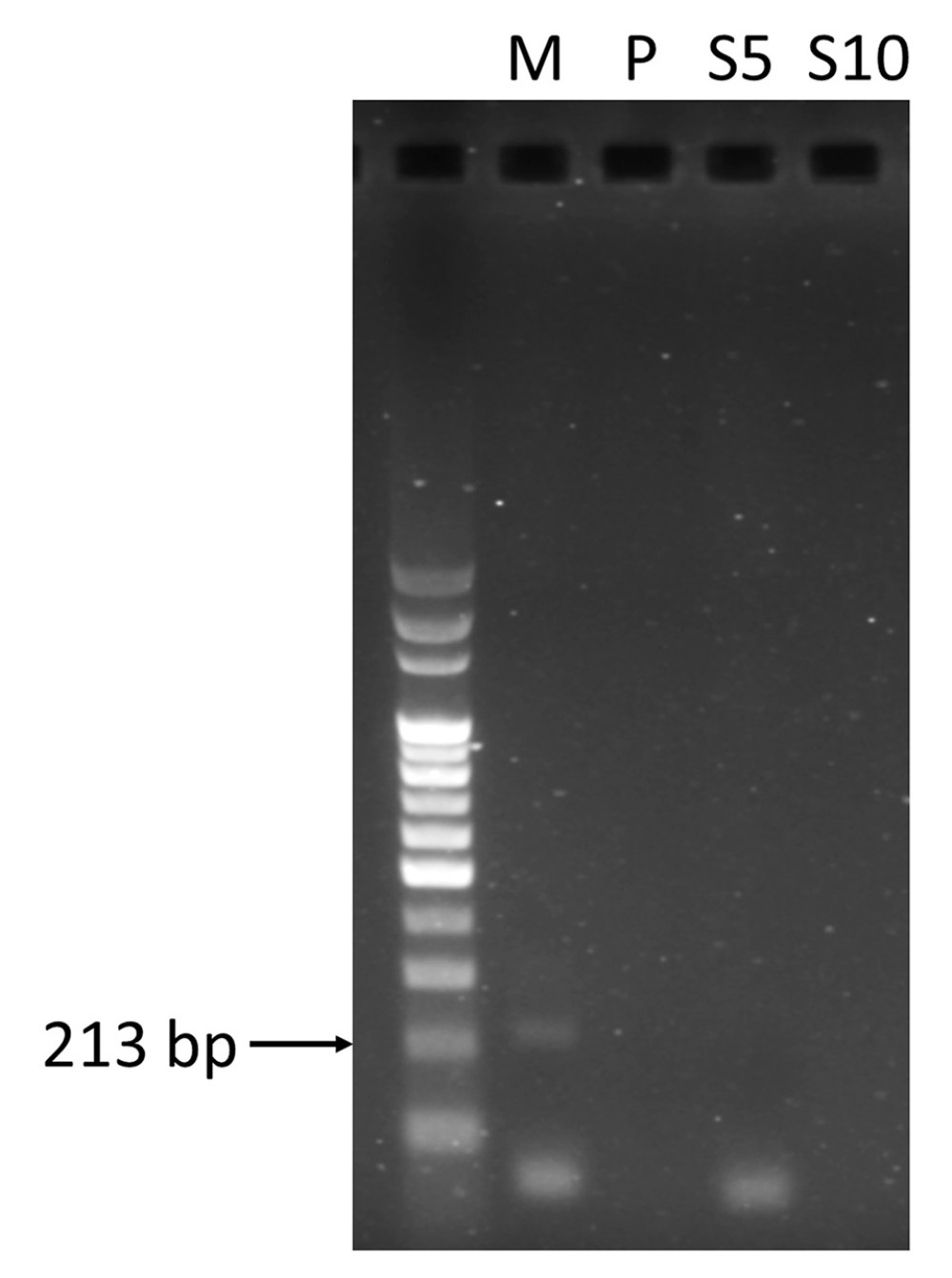 Agarose gel electrophoresis of PCR amplification for mitochondrial cytochrome oxidase subunit 1 (CO1) gene. P – CSF pellet mixed with 2 primers; S5 – 5 μL supernatant of CSF mixed with 2 primers; S10 – 10 μL CSF supernatant mixed with 2 primers. The first lane indicates a 100-bp ladder DNA size marker and the arrow indicates the size (213 bp) of the expected PCR products.