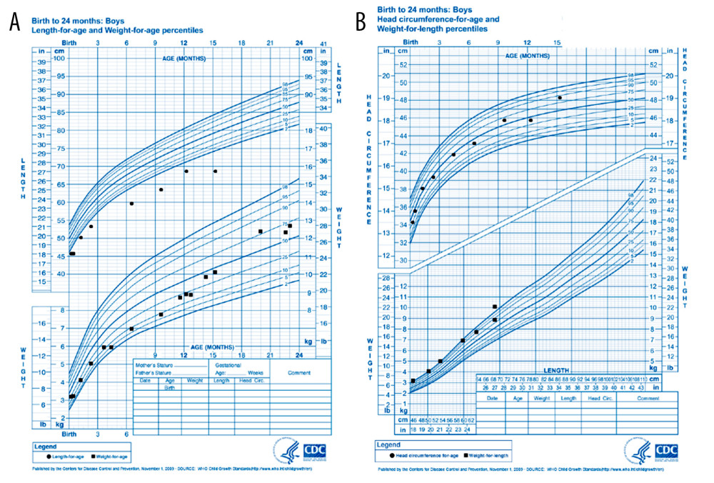 Birth to 24-month growth chart. (A) Length-for-age and weight-for-age percentiles; (B) head circumference-for-age and weight-for-length percentiles. Note the patient’s short stature compared with normal weight and head circumference throughout the growth curves.