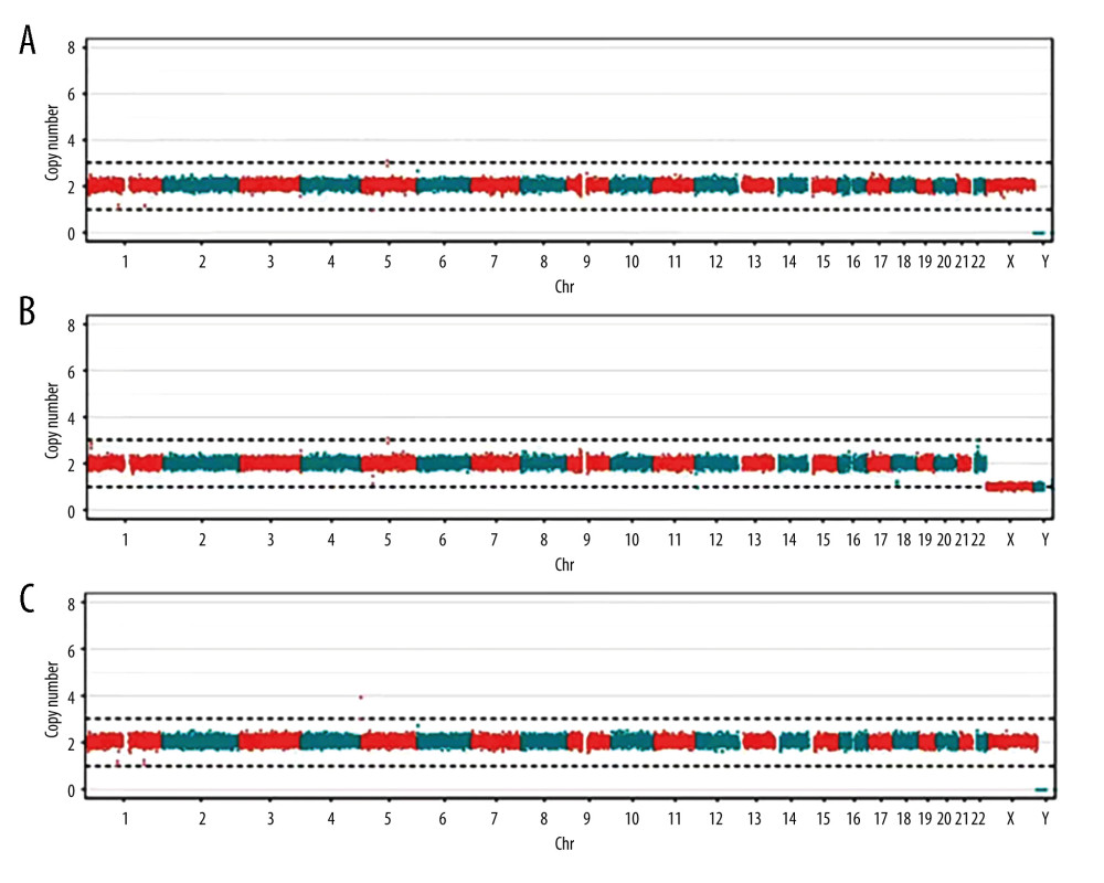 Results of whole-genome detection. (A) Proband (female, patient). (B) Father (male, normal). (C) Mother (female, normal).