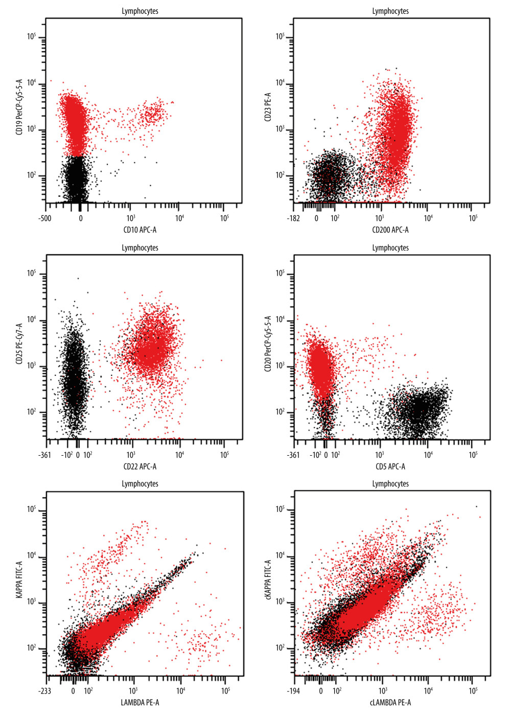 Flow cytometry analysis of the B lymphocytes. The lymphocytes are gated as follows: red, B cells; black, T cells. Most B cells lack light chain expression, with a minor subset of normal B cells demonstrating a polytypic light chain expression.