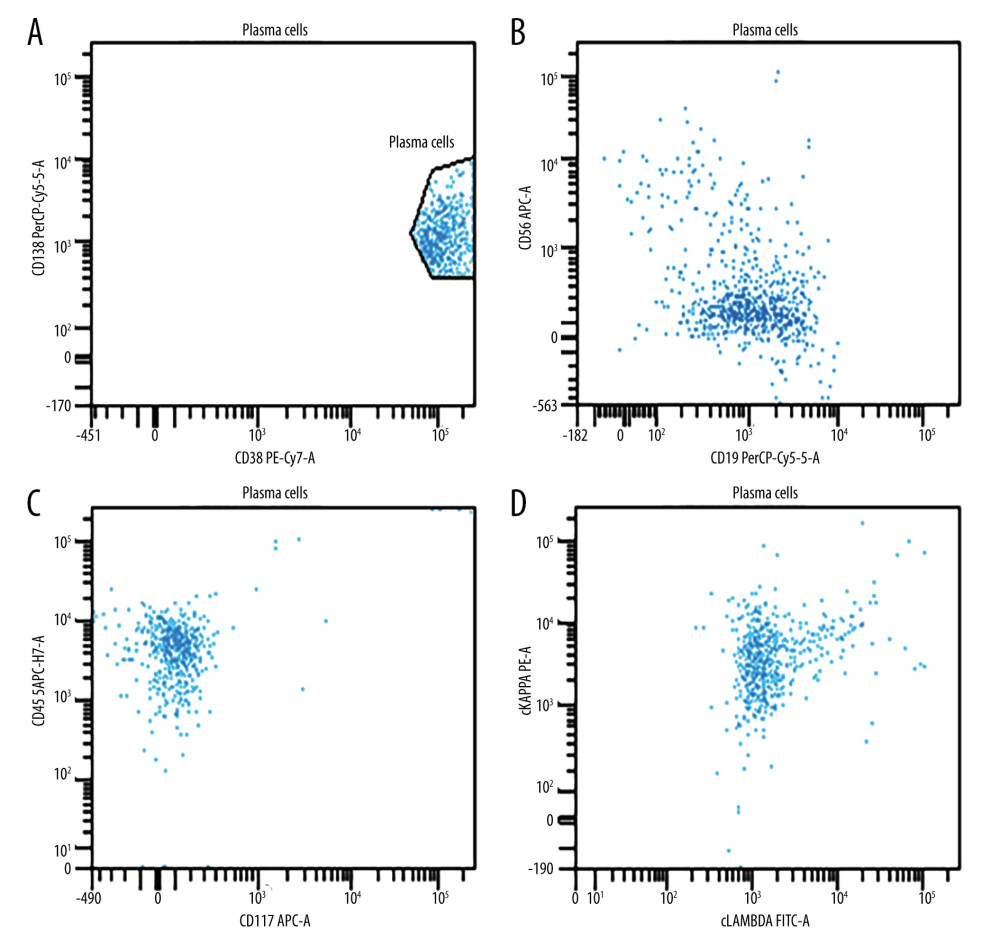Flow cytometry analysis of the plasma cells. (A) Plasma cells are gated based on CD138 and bright CD38 expression. (B–D) Neoplastic plasma cells are CD56 and CD117 negative and show no definitive light chain restriction/expression by intracellular studies.