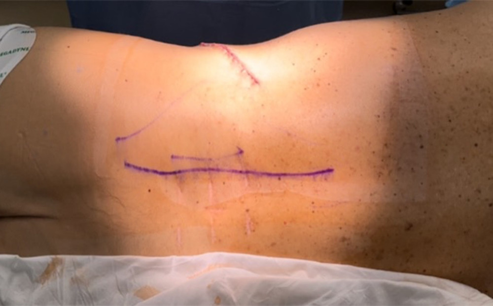 Postoperative physical examination image.
