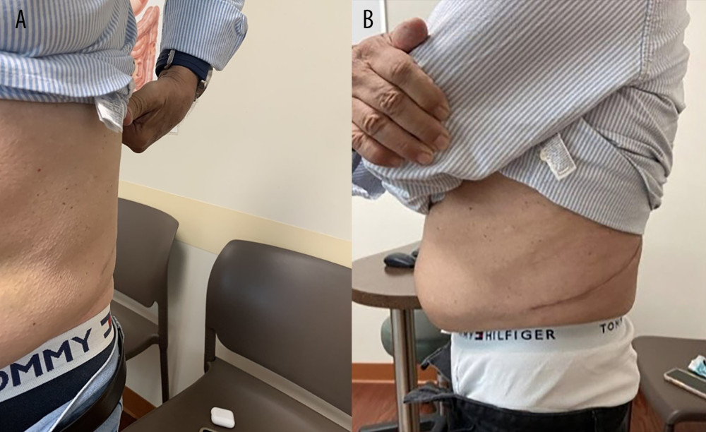 (A, B) Follow-up images.
