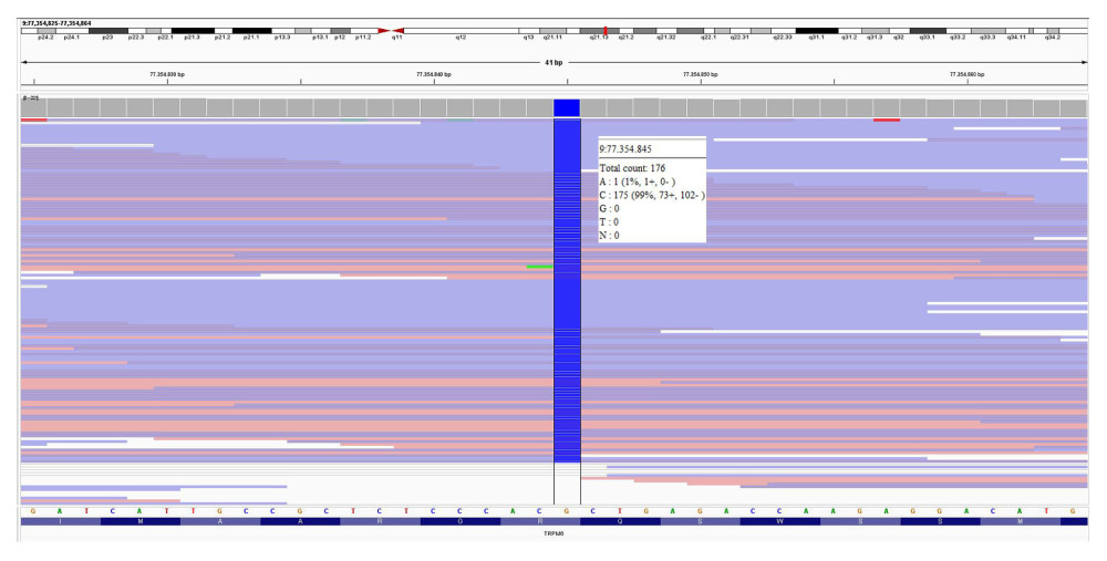 Whole-exome sequencing analysis of the affected patient led to the identification of the homozygous variant c.5281C>G p. (Arg1761Gly) in the TRPM6 gene (the genomic variant is depicted in blue using IGV software). This cytosine-to-gua-nine substitution variant leads to an amino acid substitution that is predicted to result in a pathogenic effect by 8 out of 22 bioinformatic in silico programs. Allele frequency of this variant in the general population has not been documented (gnomAD v2.1.1 controls).