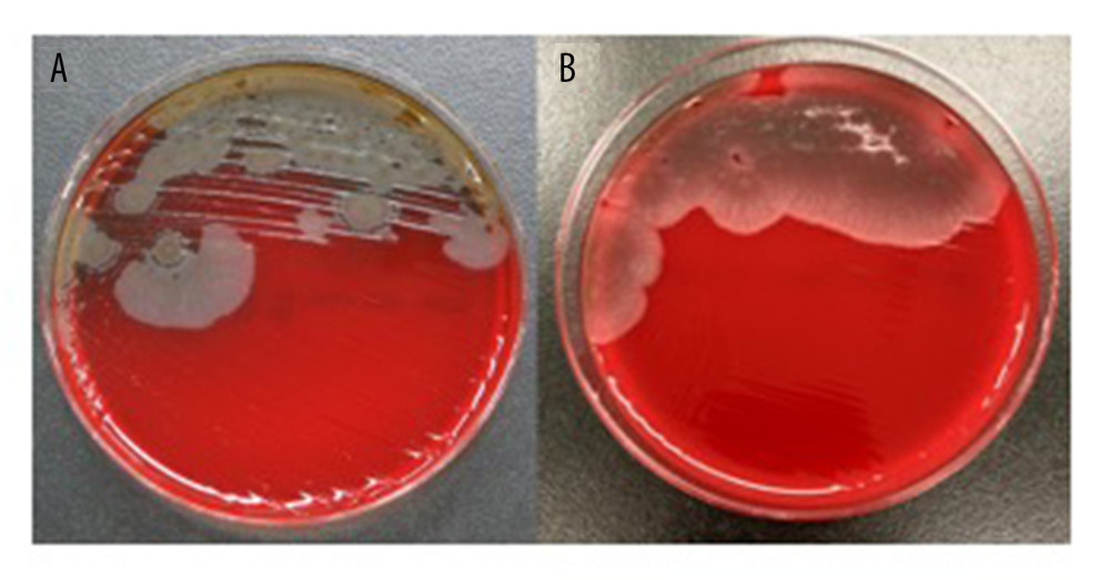 (A, B) Colony of the B. subtilis in the blood agar gel.