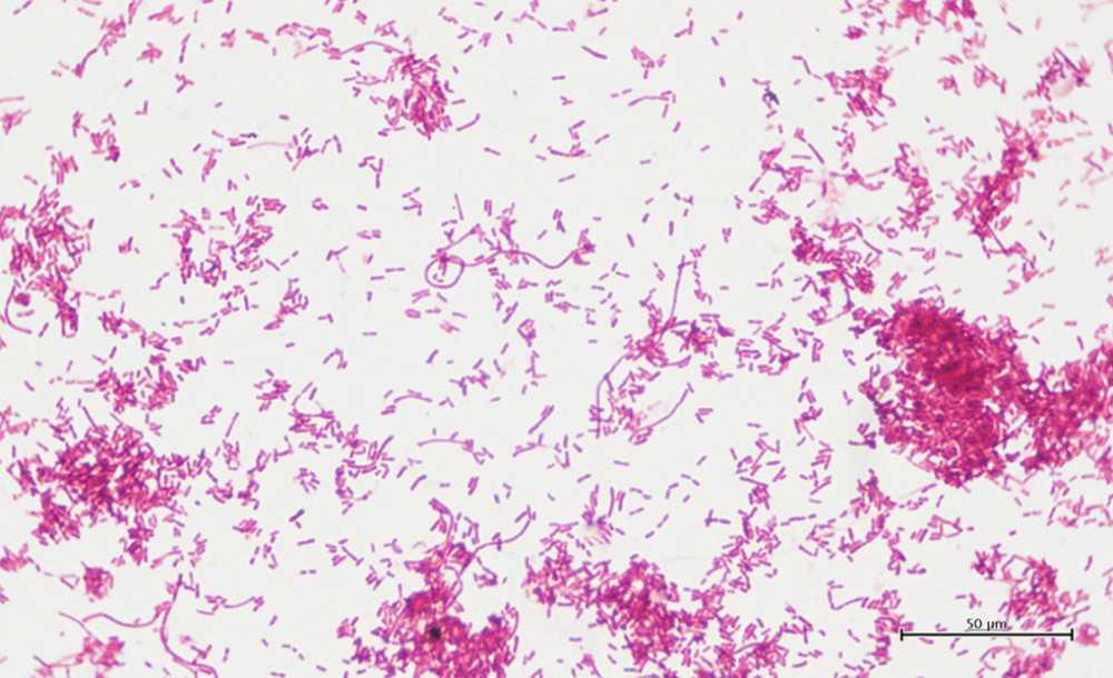 Gram stain of Fusobacterium necrophorum isolated from blood culture, demonstrating characteristic pleomorphic gram-negative bacilli. Scale bar is 50 µm.