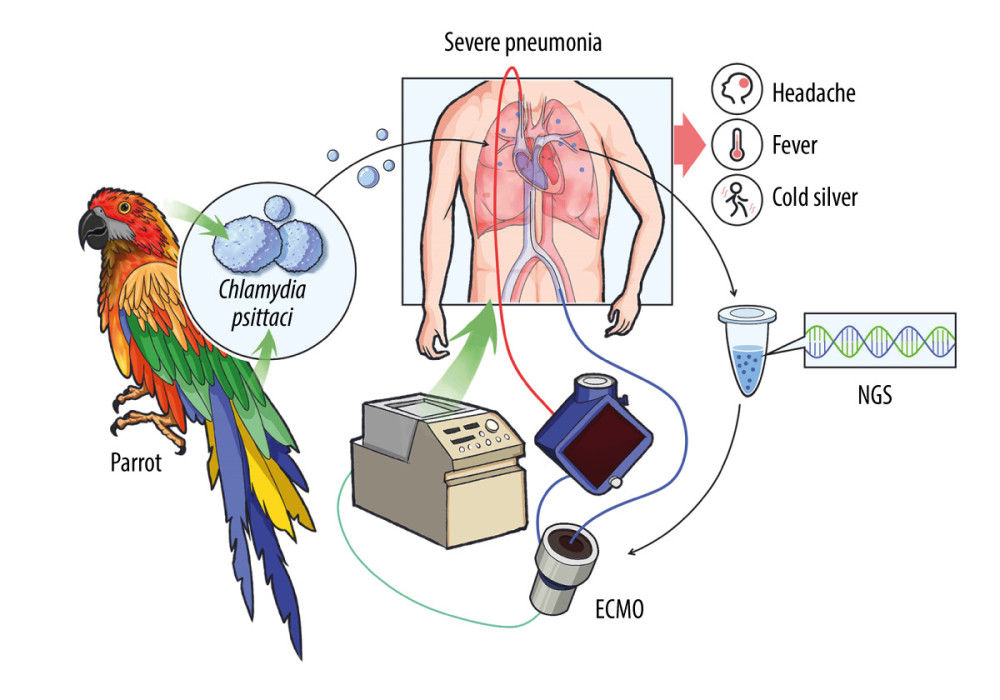 Diagnosis and treatment flow of patients with severe infection with atypical pathogens. extracorporeal membrane oxygenation (ECMO) support was given when metagenomic next-generation sequencing (mNGS) was tested. Figure used with permission from Willing Technology (Beijing) Co., Ltd.