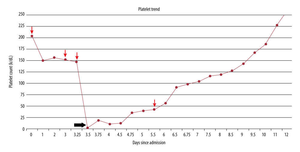 Platelet trend. Thin red arrows indicate transfusions. Thick black arrow indicates onset of IVIG and steroids.