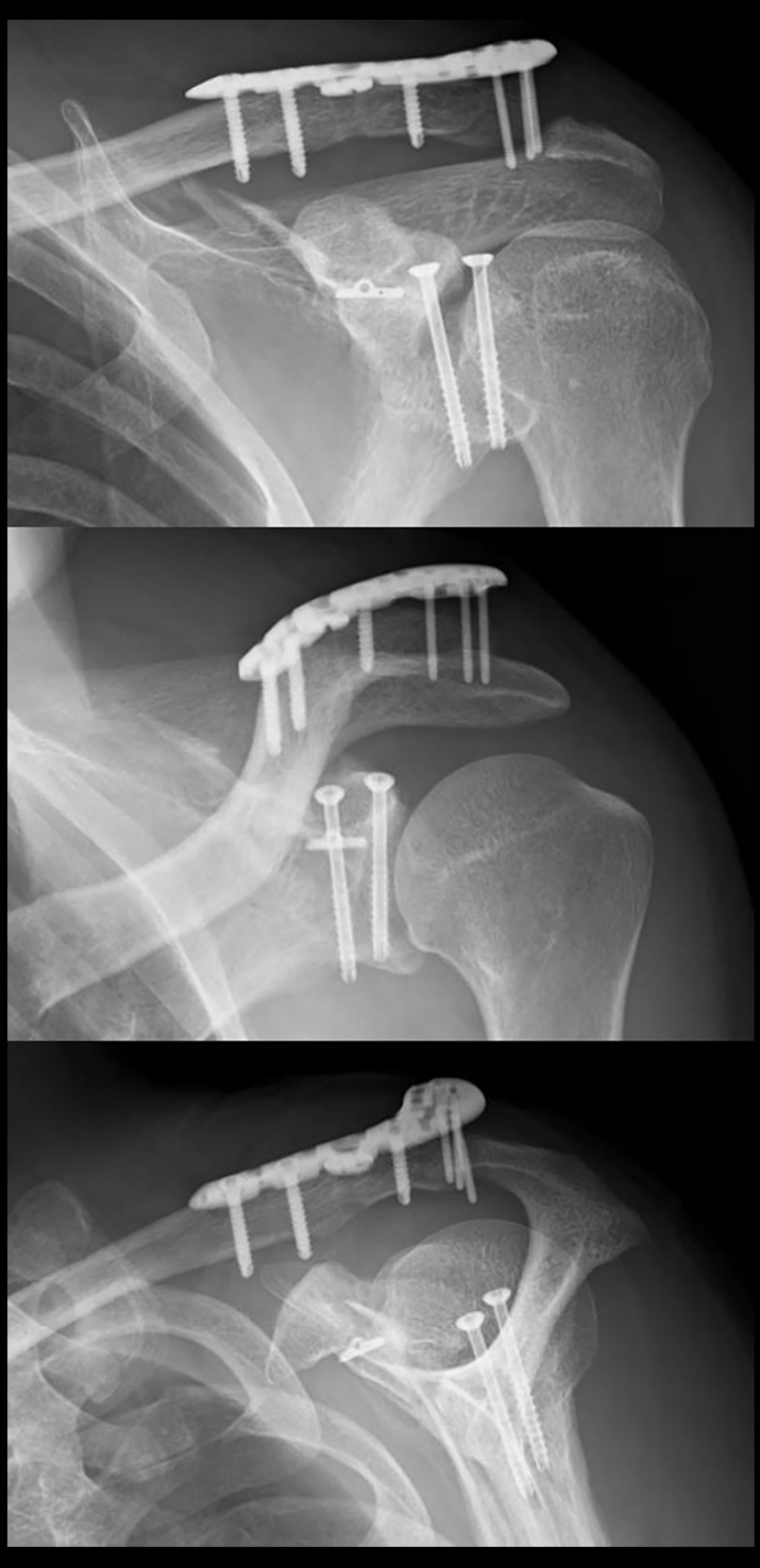 Radiographs immediately after surgery.