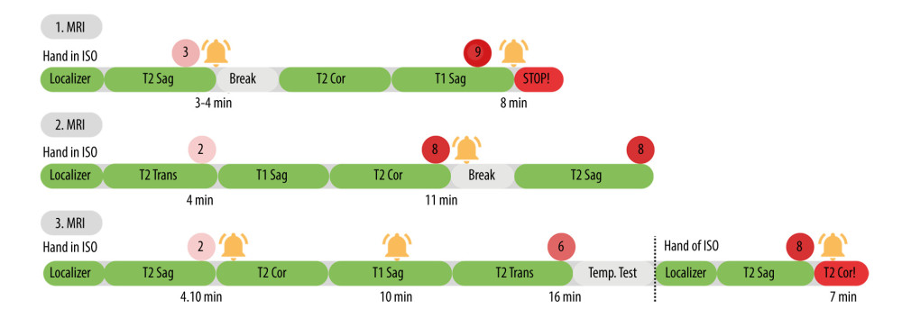 Timeline of MRI Sessions. The bell icon denotes the activation of the alarm. Numbered red circles indicate the visual analog scale (VAS) of pain. Green bars represent the scanning sequence, red bars the stopped sequence.