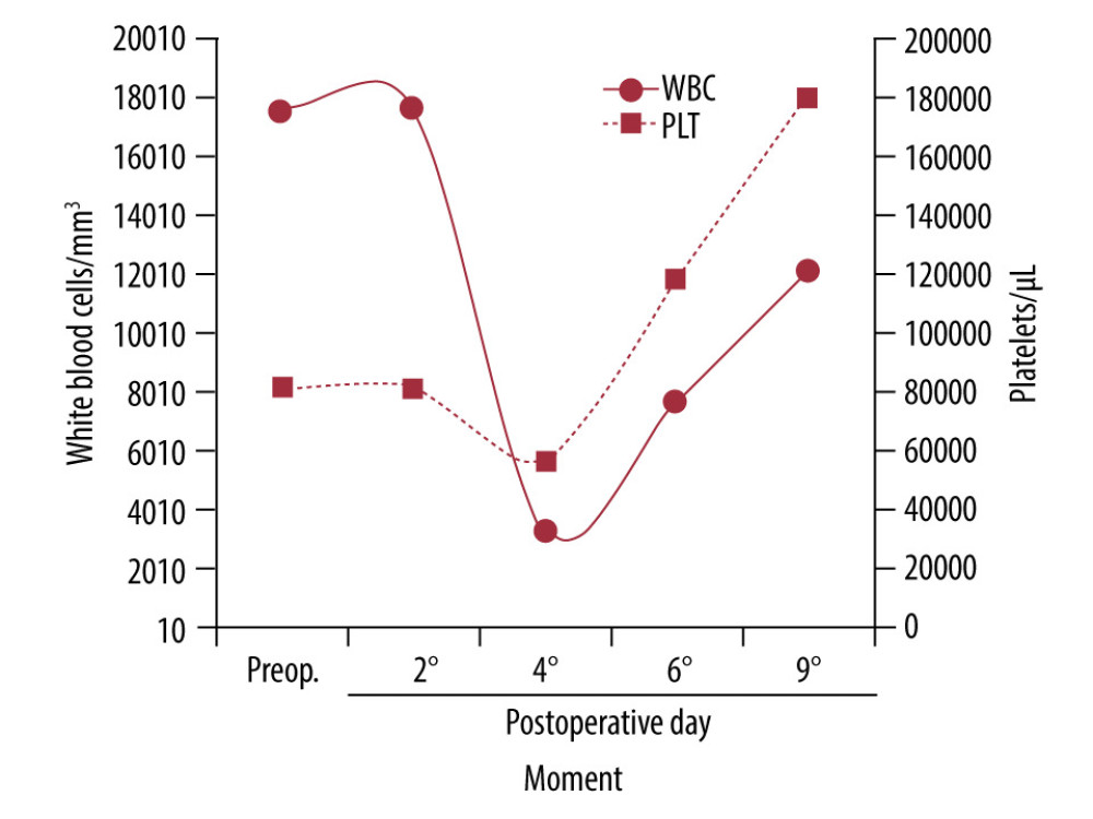 Variation of levels of white blood cells (mm³) and platelets (μL). Assessment performed preoperatively (Preop) and postoperatively (days 2,4,6, and 9).