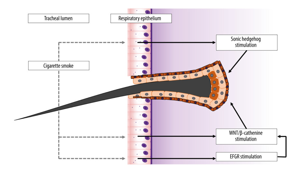 Possible cellular signaling pathways affecting endotracheal hair growth. All pathways are enhanced by smoking in respiratory epithelial tissue and simultaneously integral mediators in hair follicle morphogenesis and stimulation. This figure was created by the authors using the Microsoft Office 365 PowerPoint program.