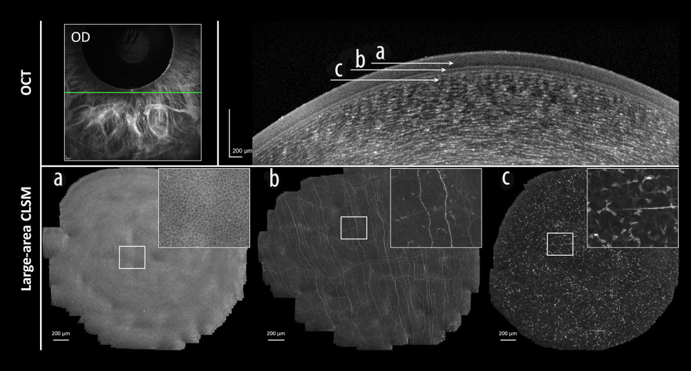 Correlative imaging using high-resolution optical coherence tomography (OCT) and large-area confocal laser scanning microscopy (CLSM). Non-invasive biophotonic imaging of a control cornea in a constellation comparable to Figure 2.