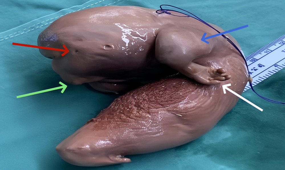 The fetal body can be seen, organs such as the mouth (green arrow), eyes (red arrow), trunk, forearm (blue arrow), and hand (white arrow) are visible.