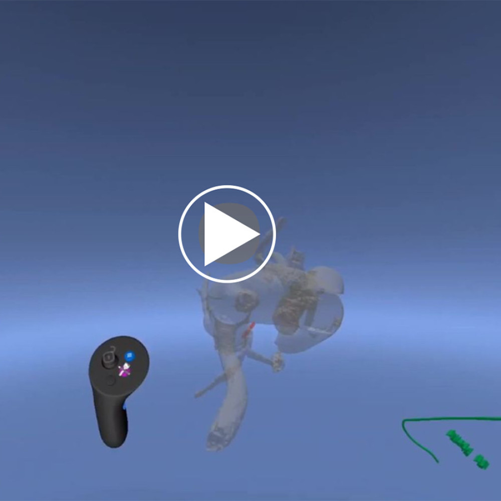 Video 1. Guide catheter simulation by virtual reality.