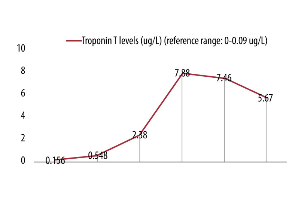 Graphical representation of troponin T levels.