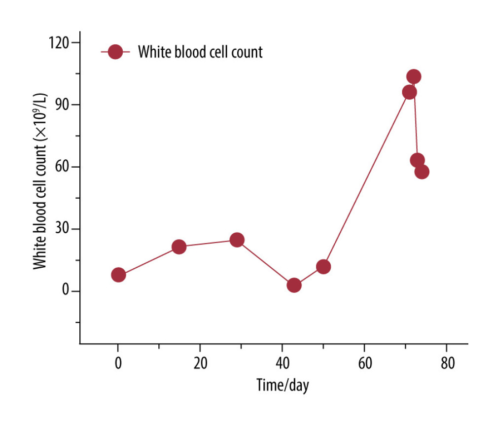 White blood cell (WBC) count in Patient A. The x-axis (Time/day) represents days since 31 July 2024 (Day 0), when hepatic metastases were first identified. The y-axis indicates the WBC count (×109/L). An initial rise in WBC count was observed from Day 0 to Day 30, followed by partial stabilization, then a marked increase after Day 51, corresponding to disease progression and clinical deterioration.
