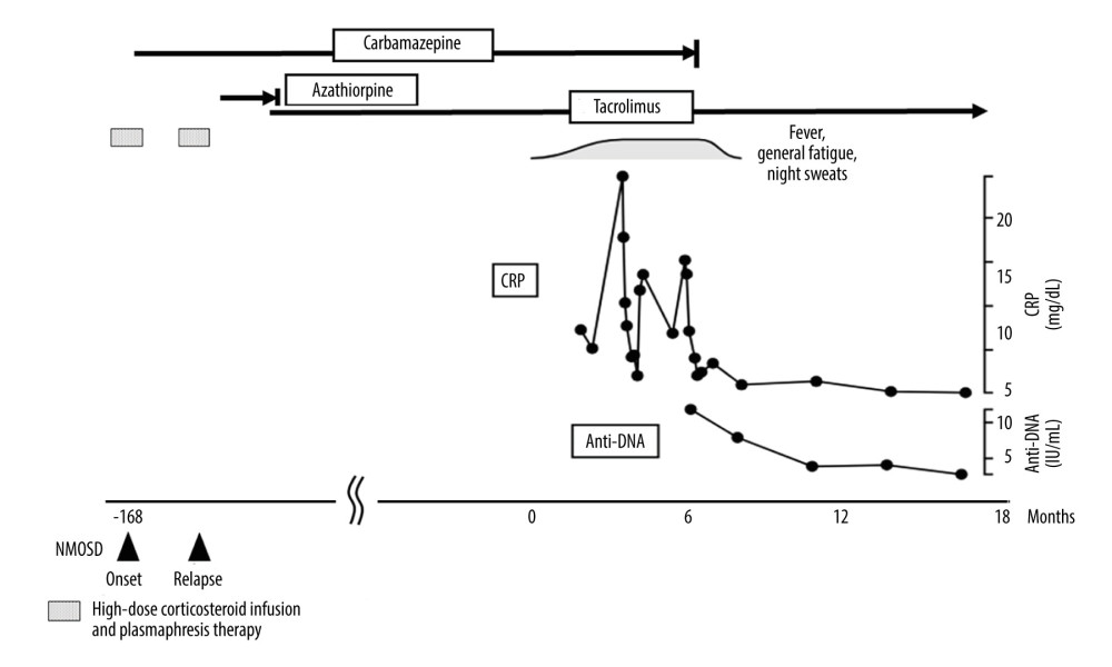 Clinical course of the patient. Timeline depicting the patient’s clinical course, including onset and progression of systemic symptoms, CRP levels, and anti-DNA antibody titers before and after discontinuation of carbamazepine. After carbamazepine withdrawal, systemic symptoms resolved; CRP levels and anti-DNA antibody titers both decreased. CRP – C-reactive protein; NMOSD – neuromyelitis optica spectrum disorder.