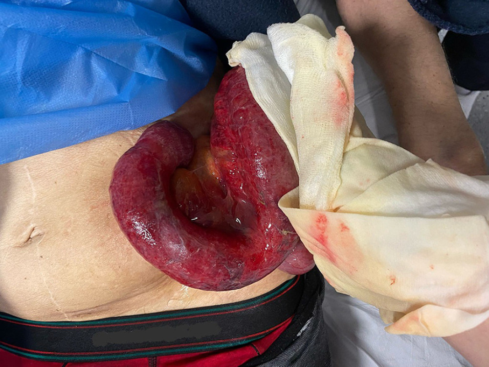 Clinical appearance upon presentation in the Emergency Department.