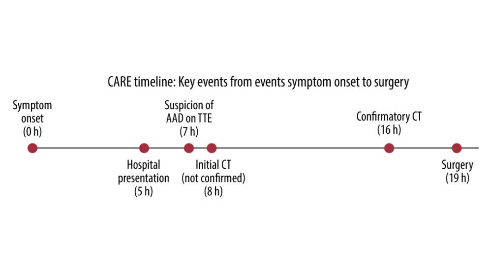CARE timeline illustrating key diagnostic and therapeutic events from symptom onset to surgery. CARE – CAse REport guidelines; AAD – acute aortic dissection; TTE – transthoracic echocardiography; CT – computed tomography.