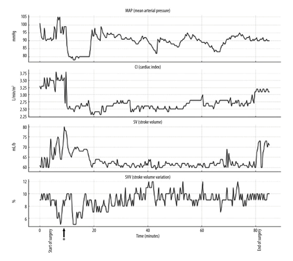 Hemodynamic parameters recorded during laparoscopy. * Start of pneumoperitoneum.