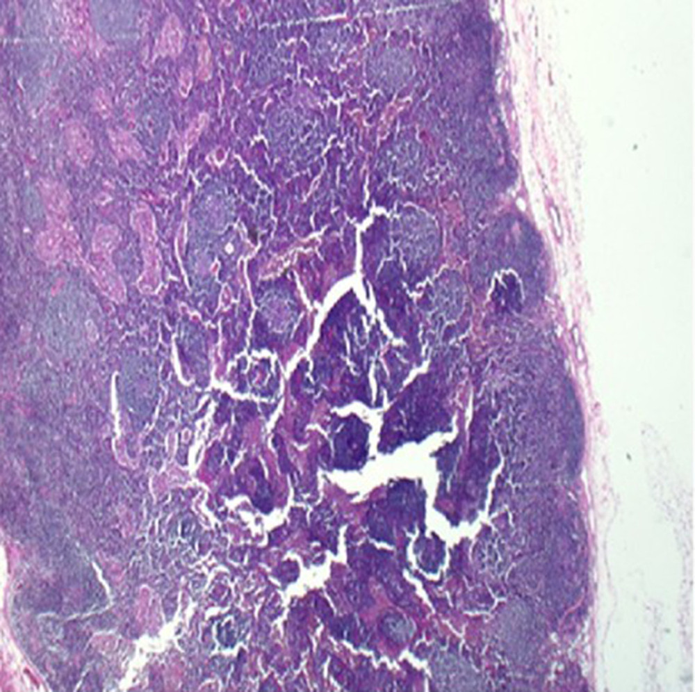 A representative micrograph from one of the lymph nodes showing normal lymph node architecture with lymphoid follicles and sinusoids, without any evidence of metastatic tumor.