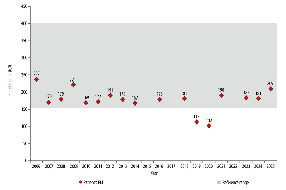 Longitudinal changes in platelet count during follow-up.Longitudinal changes in the patient’s platelet count over time. Reference ranges are indicated by shaded areas and were derived from the laboratory reports available at each time point. Data labels represent the patient’s individual values at each time point.