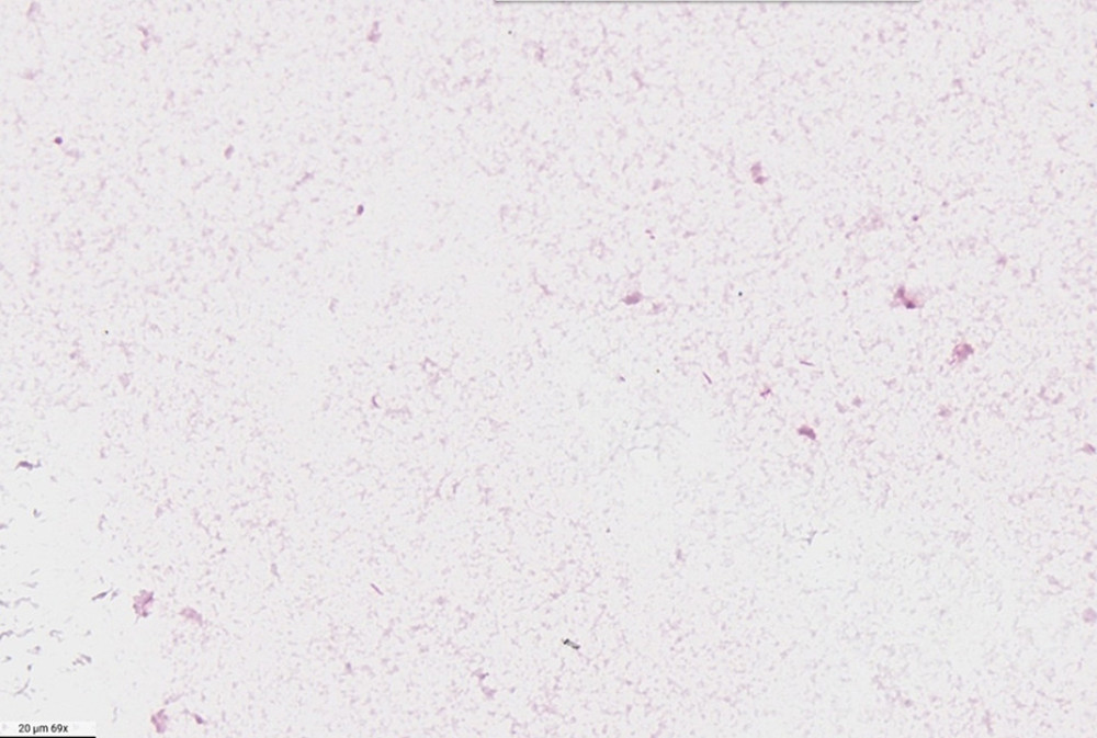 Gram stain from an anaerobic blood culture bottle showing gram-negative bacilli (80 × magnification).