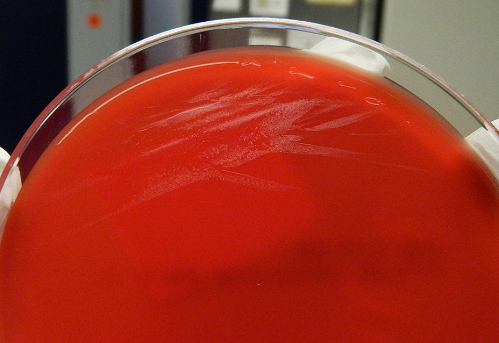 Growth on a blood agar plate after 12 hours, demonstrating yellow-beige colonies.